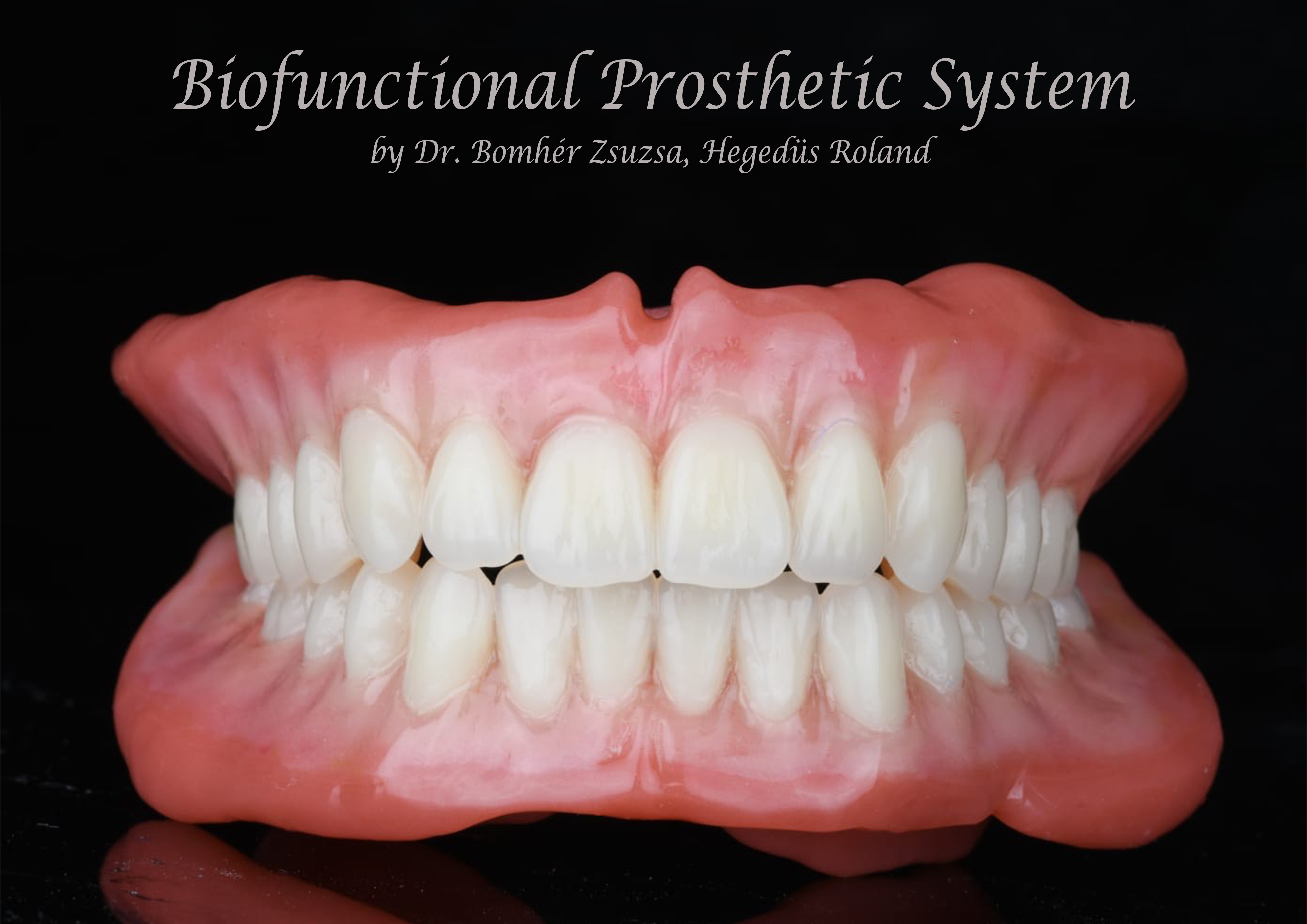 Biofunctional Prosthetic System fogsor laborháttér bemutatásához