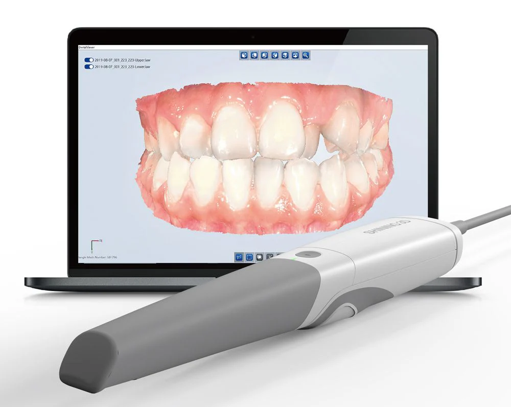 Intraorális scanner render digitális fogászati workflow bemutatásához